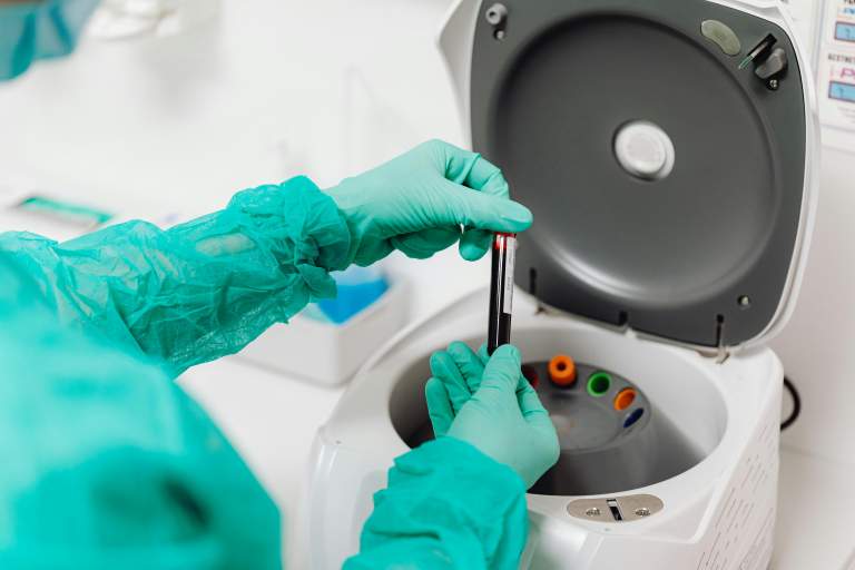How PRP is Disease-Modifying for Osteoarthritis (OA)