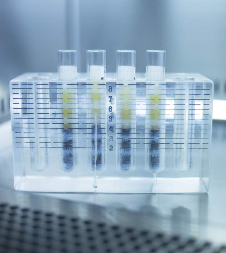 PRP Treatment Advances: No Longer Experimental