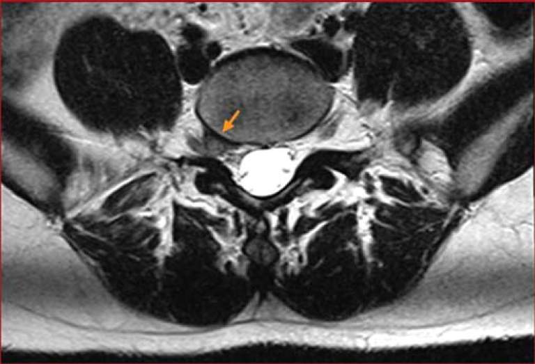 Article Publication in Journal of Orthopedic & Sports Physical Therapy